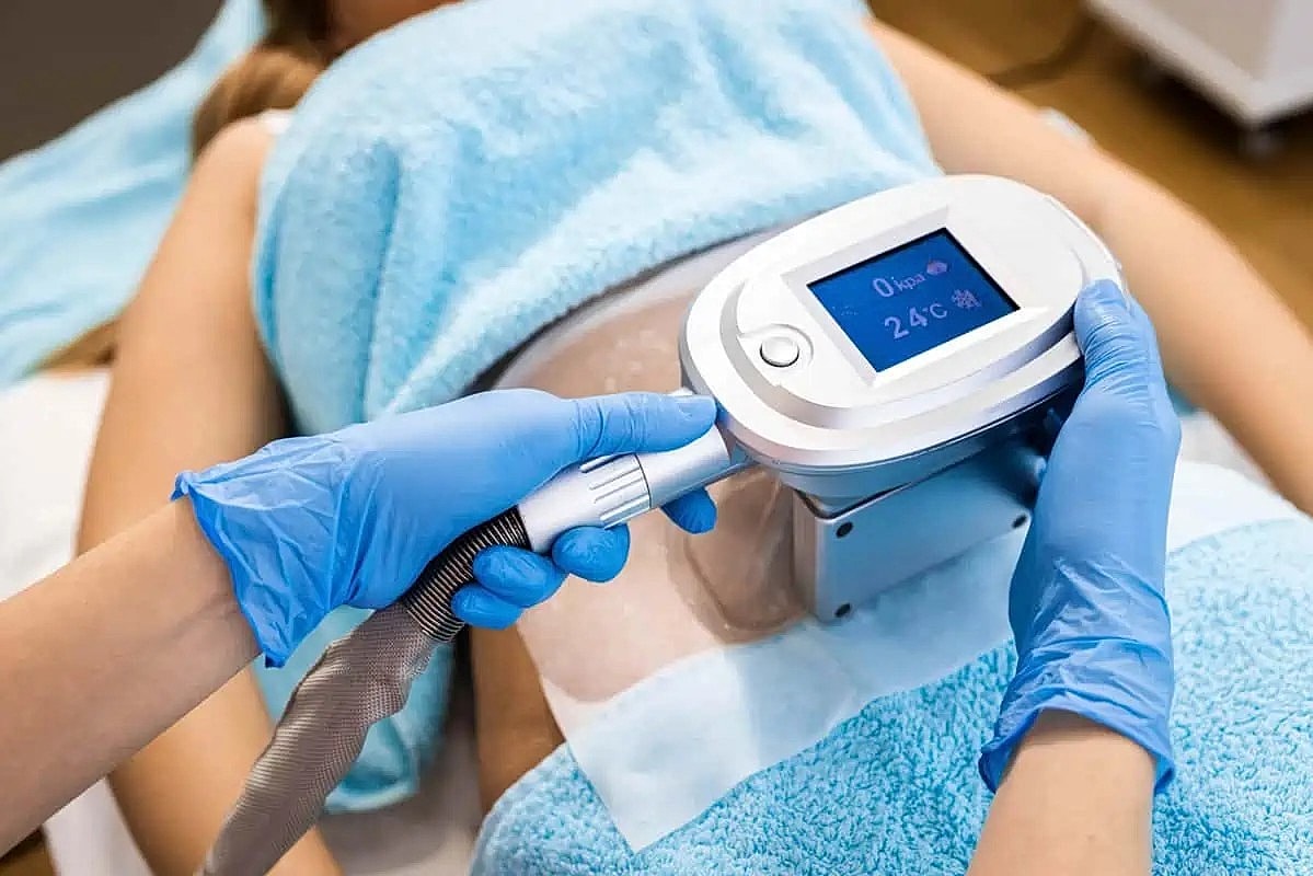 What to Expect from CoolSculpting Treatments: During and After