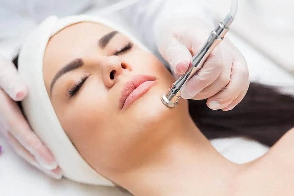 RF Microneedling for Wrinkle Reduction: A Non-Surgical Alternative