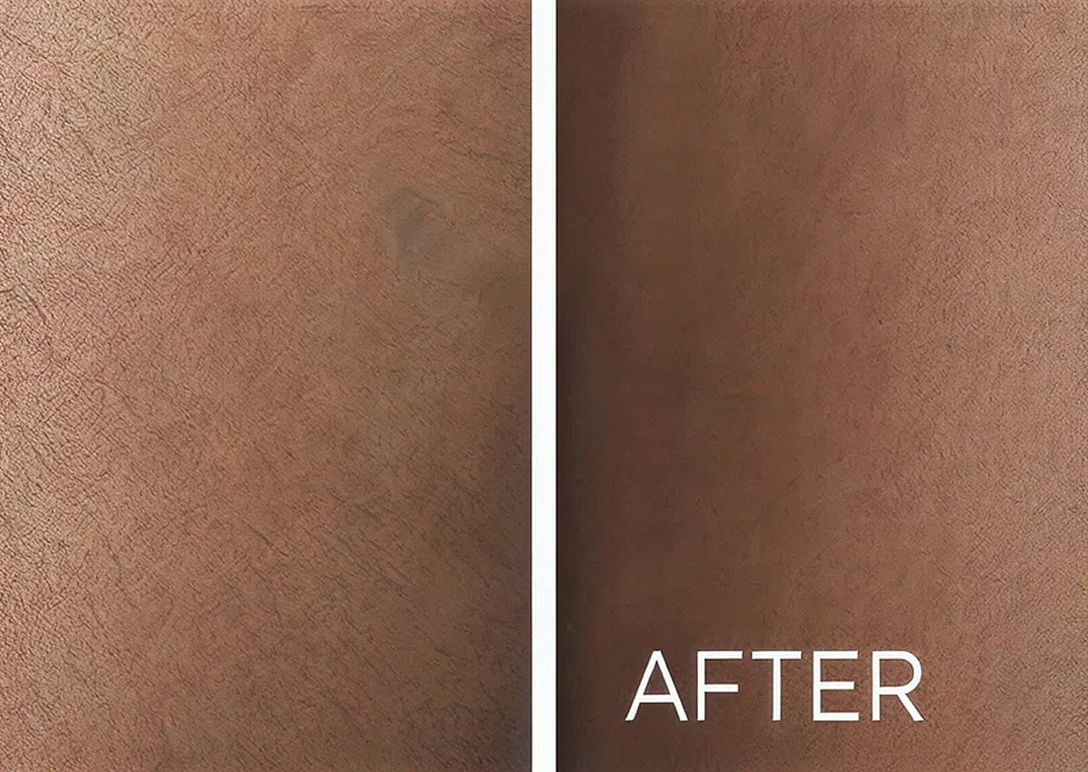 Renovo Laser Hair Removal Before And After Leg | Best Medical Spa in Northborough, MA