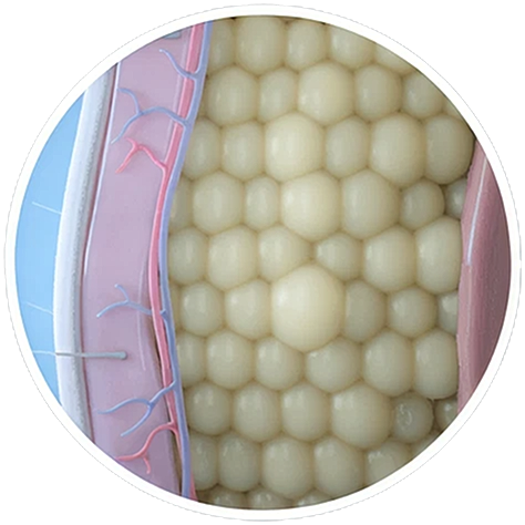 CoolSculpting in Northborough, MA